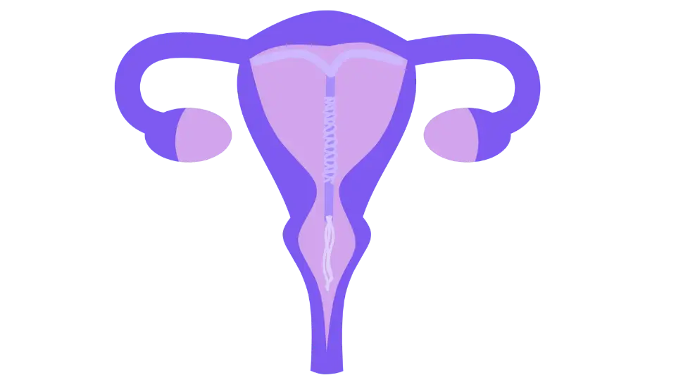 IUD Edmonton medical abortion edmonton vasectomy